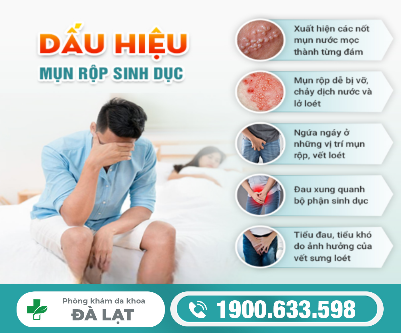 Hình ảnh minh họa